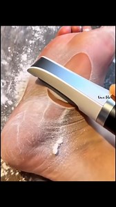 39K views · 101 reactions | Say goodbye to rough, cracked heels with our Foot Callus Remover! Removes dead skin & calluses instantly Gentle yet powerful Safe & easy to use at home No more salon | Home Idea | Facebook