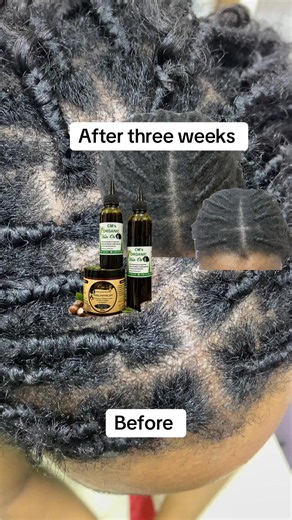 After three weeks vs Before: viral transformation clip