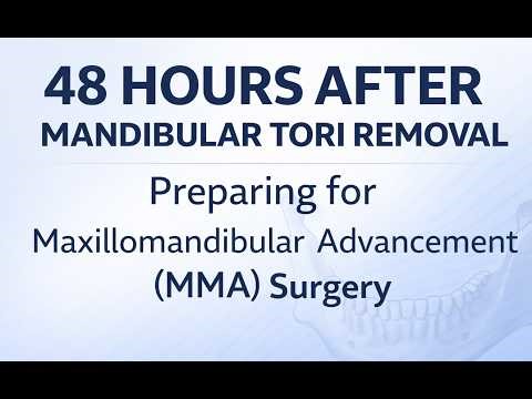 48 hrs after Tori removed - Prepping for #jaw #Surgery #journey