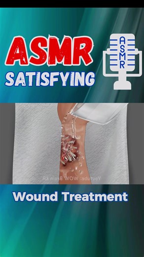 Wound Treatment ASMR ! #asmranimation #animation #satisfyingvideosdaily #asmrskincare #woundtreatment