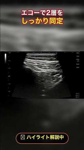 【実践】仙腸関節性腰痛、8割は「関節の外」って知ってましたか？