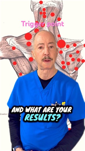 What should trigger point injections actually feel like—and how do you know they’re working?