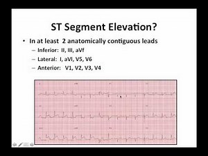 STEMI Tutorial Part 1