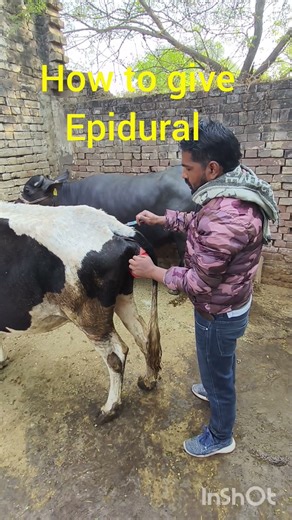 how to give epidural injection| vicky saini