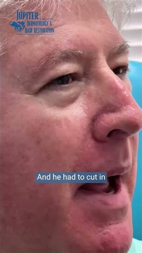 Mohs Surgery Recovery | Mohs Surgery & Nasal Reconstruction