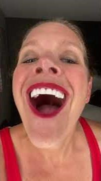 Removable Veneers USA, Best Clip On Veneers Review, Another Happy Client, #1 Snap On Veneers