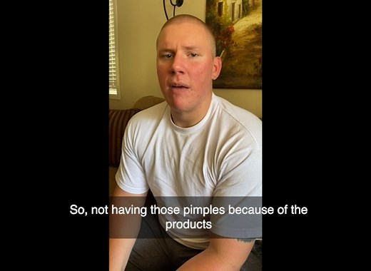 Hydro-Glo Peel Pads - Enhanced with Kojic, Mandelic, Glutathione, Licorice, Papaya, Pineapple, Bearberry Extracts (40% Strength)