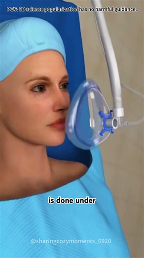 Maxillary osteotomy procedure to fix misaligned upper jaws #drone #theflash #space