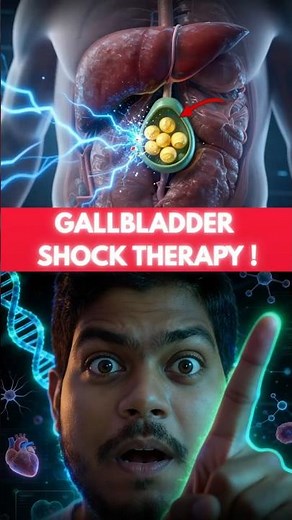Gallbladder Stones Without Surgery? 😳 Shock Wave Treatment (ESWL) Explained!