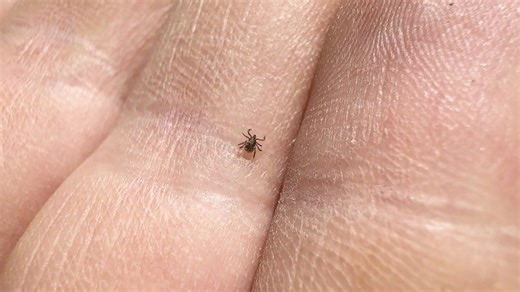 What You Need To Know About Ticks Before You Head Outdoors