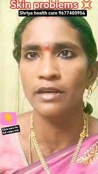 Skin problems 💢 #shorts #viral #trending #health #skinproblems #skin #skincare #healthtips #tamil