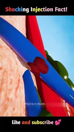 Doctor Injection Mistake Caught in 3D: The Truth Behind Blue Skin!