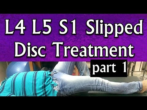 L4 L5 S1 Slipped Disc Treatment - EXERCISES To Treat Slipped Disc At Home Completely PART- 1