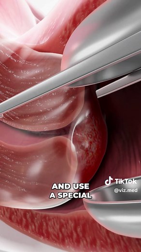 Understanding Cervical Biopsy After Abnormal Pap Smear Results