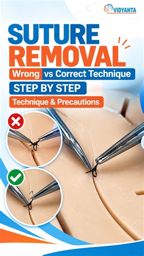 Correct way to remove sutures (Don't make this mistake!) #medicalstudent #sutures