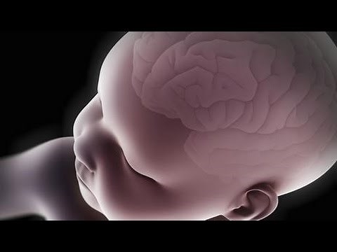 Shuddering attacks in children