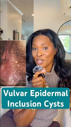 Vulvar Epidermal Inclusion Cysts. Causes, Symptoms & When to Get it Checked