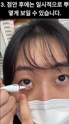안연고 넣는 방법 (간략하고, 정확한 설명)-면봉 NO!! (안연고 유통기한 : 개봉 후 한달만 사용!!)