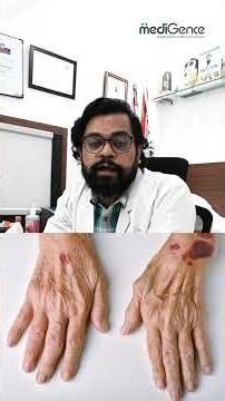 Why Are Platelets Important? Understanding Low Platelet Count.