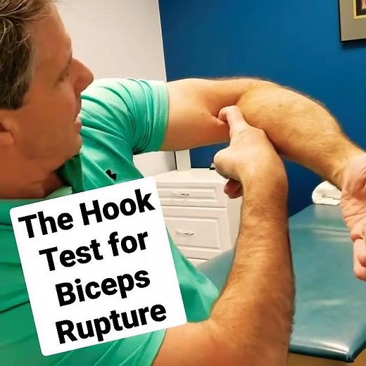 The HOOK TEST for a biceps rupture. #shorts