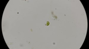 The Movement of the Protozoa Euglena Viridis, Under the Microscope