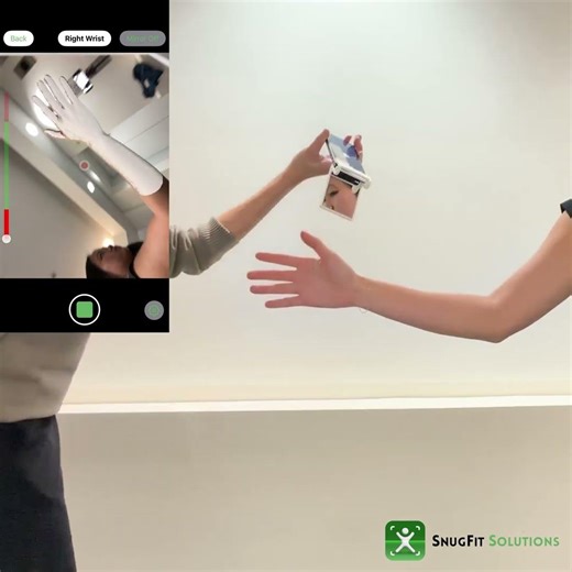 Wrist capture using SureScan 3D Mirror