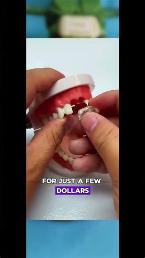 Fix Missing Teeth at Home with Easy Dental Filling Material! #DIYToothRepair