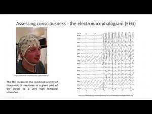 The reticular formation and consciousness