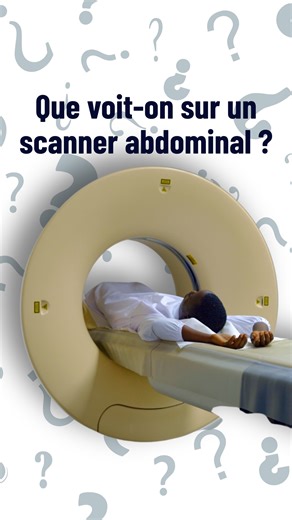 Dr El Amine Rayan on Instagram: "On entend parler du scanner... mais savez-vous tout ce qu'il permet de voir dans l'abdomen ? #Scanner #Radiologie #Abdomen"