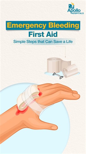 91 reactions · 3 comments | Bleeding won’t wait, neither should you. In an emergency, the first few seconds matter. Learn quick, effective steps to control bleeding, whether it’s from a deep wound or a nosebleed. Watch now and be prepared to save a life. #ApolloHospitals #TouchingLives #BeProHealth #FirstAid #EmergencyCare #StopTheBleed #HealthTips #BePrepared #EmergencyReady | Apollo Hospitals | Facebook