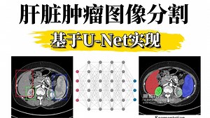 强推！医学图像分割实战来袭：U-Net模型搞定肝脏肿瘤图像分割，从搭环境到实战，一学就会！图像分割/深度学习/计算机视觉