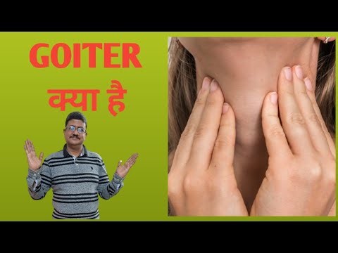 GOITER (गलगंड) क्या है?
