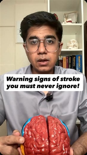 Dr Rahul Chawla | Neurologist on Instagram: "What you must know: ✅ Stroke presents suddenly and there may not be any headache or any warning symptom before. Symptoms: sudden weakness, slurred speech, facial droop, sudden vision loss, imbalance. ✅ Golden window: 4.5 hours. Beyond that, clot-busting injection (tPA) may not help. ✅ Every minute counts — 2 million brain cells die per minute. (American Stroke Association). ✅ Prevention: control BP, diabetes, cholesterol; stop smoking; exercise daily;