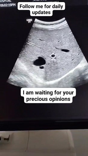 81K views · 606 reactions | A mid age female came to me with...