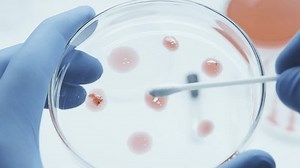 Bacteria culture growth on a petri dish in microbiology lab. Candida auris. Microbial cultures growth on selective media plate. Biomarker. Bio-reagent. Fungus and mold. Biomass. Colony-forming unit