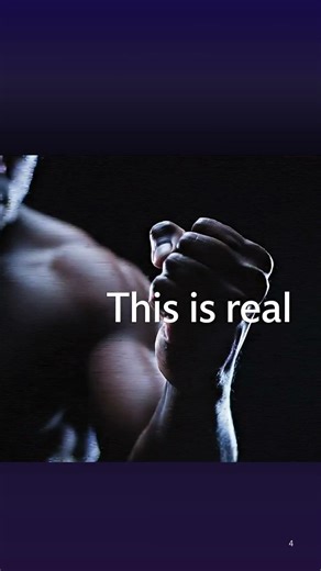 This Neurological Disorder Turns Your Hand Against You! #shorts