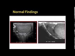 Testicular Ultrasound Podcast