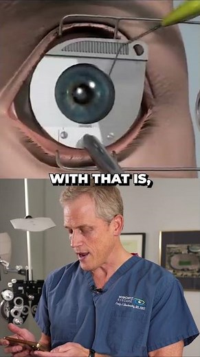What really happens during LASIK eye surgery