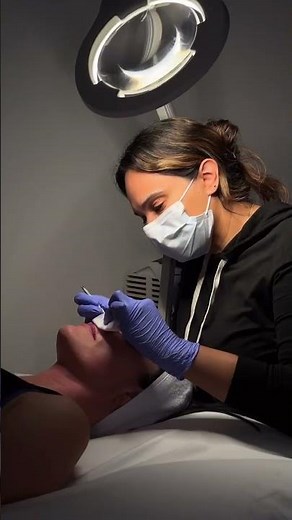 Microderm ✨ | Instant Glow at Blue Medical Spa