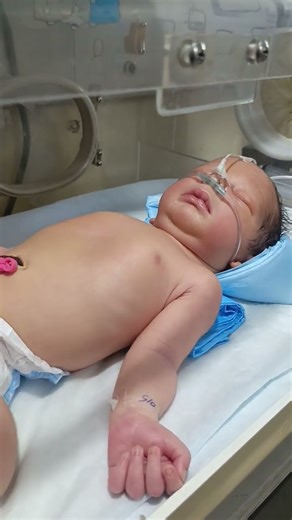 #neonatalicu #newbornbaby #criticalbaby #baby #newborn #newbornbaby #baby