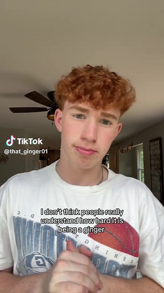 Understanding the Challenges of Being a Ginger
