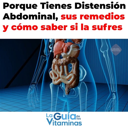 Porque Tienes Distensión Abdominal, sus remedios y cómo saber si la sufres | Guía de Las Vitaminas