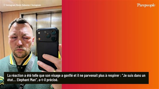 Kevin Debonne : L’ex-mari d’Inès Reg pris d'une grande allergie, il partage une photo de lui méconnaissable