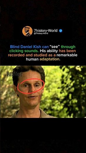 Humans with Echolocation Ability – Daniel Kish #history #americe