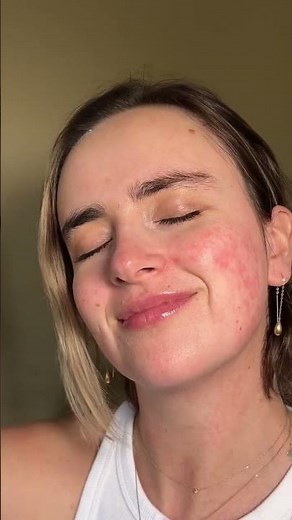 Testing Green Color Correctors for Rosacea Part 1 #fypシ #colorcorrection #rosacea #makeuptips
