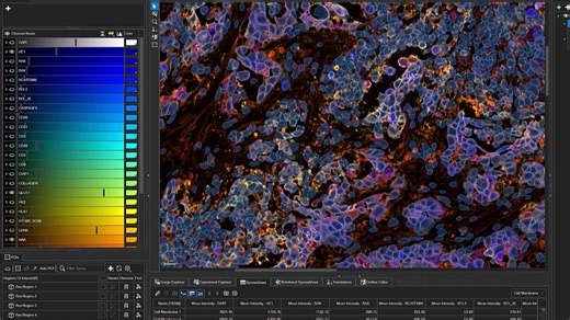 Aivia 15 革新升级