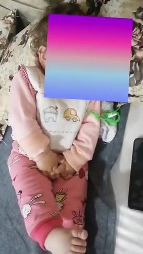 Gratification disorder mimicking epilepsy, motor stereotypes,adduction, limb scissoring dr zuhair