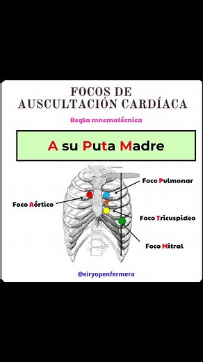 Focos de Auscultación Cardíaca: Reglas Mnemotécnicas