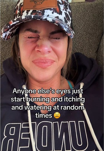 Understanding Itchy Eyes: Common Causes & Remedies