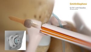 ULTRABRACE◊ Adjustable Ankle Instability Technique Animation